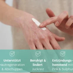 AKUT Intensivmaske ohne Duft>SIRIDERMA