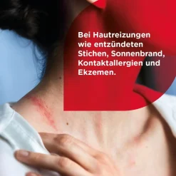HydroCortisonACETAT 0,5% Hautentzündungen><noscript><img width=