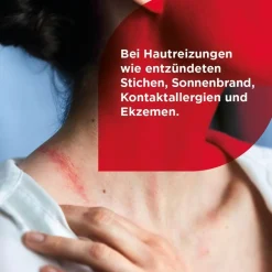 HydroCortisonACETAT 0,25% Hautentzündungen|Soventol Online