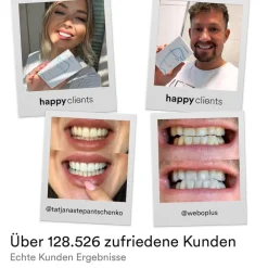Uniquesmile Zahnaufhellung Whitening Strips - frei von Peroxid| Clearance