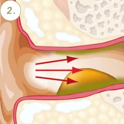 Vaxol® Ohrenspray|
