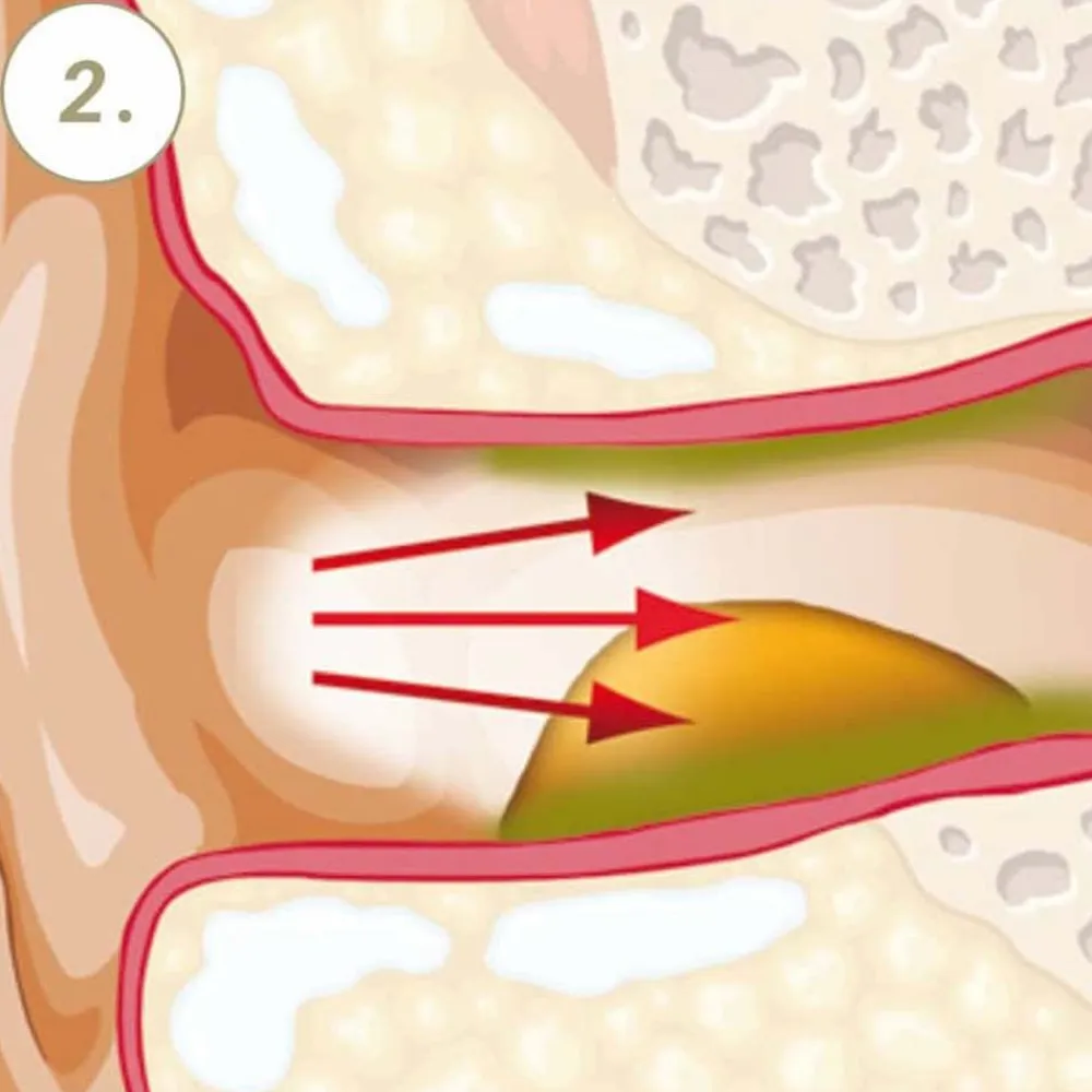 Vaxol® Ohrenspray|
