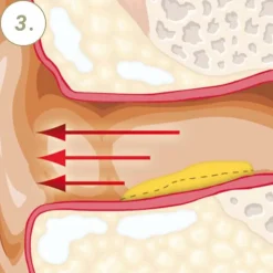 Vaxol® Ohrenspray|