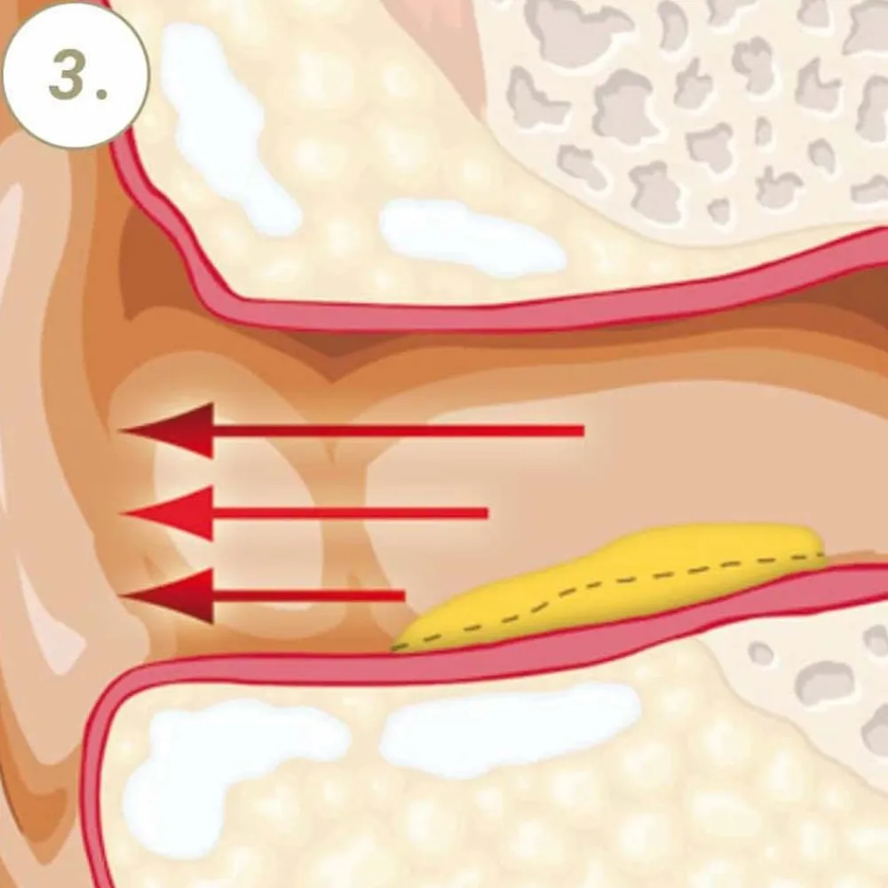 Vaxol® Ohrenspray|