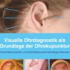 Visuelle Ohrdiagnostik als Grundlage der Ohrakupunktur> Hot