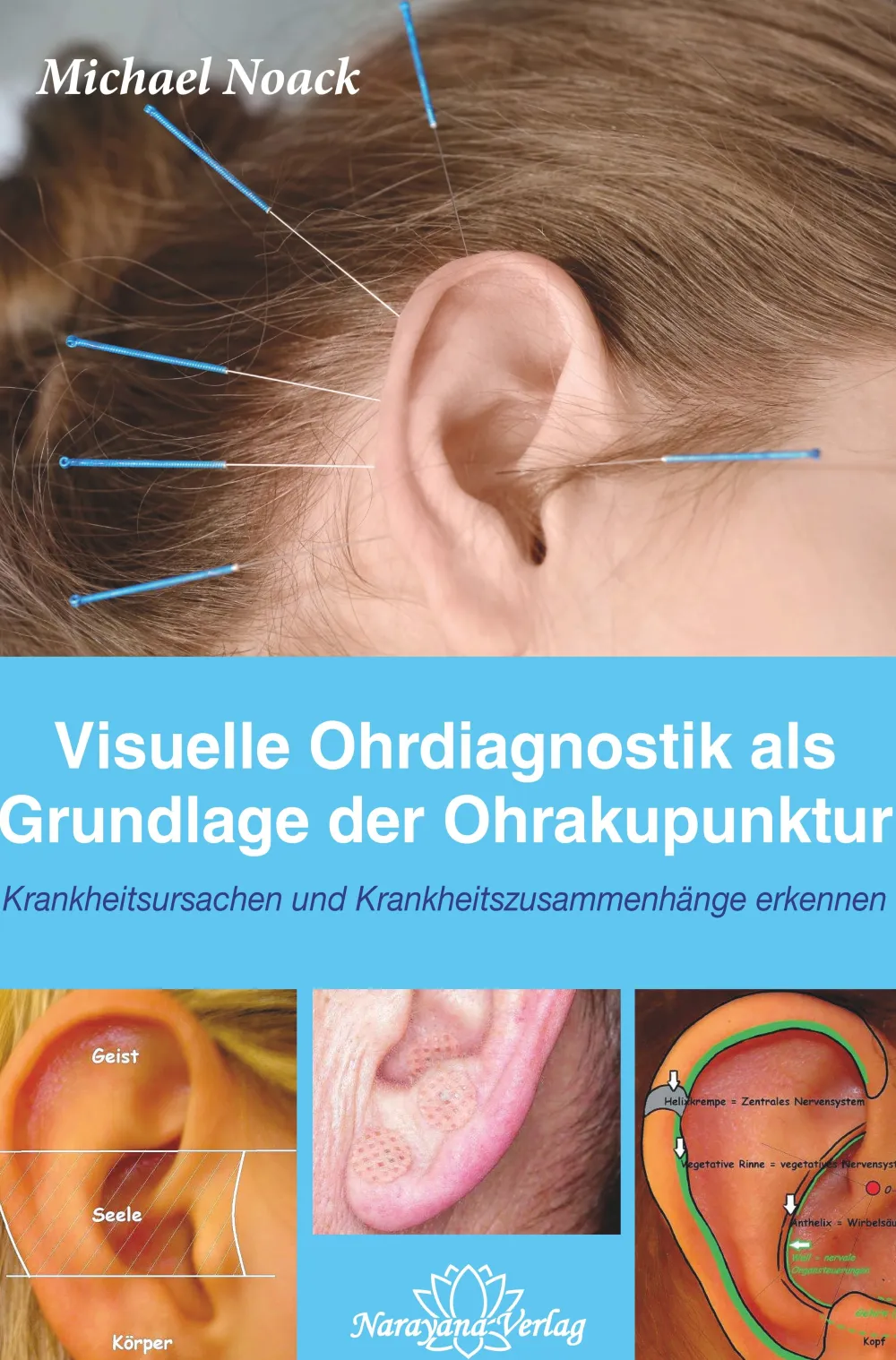 Visuelle Ohrdiagnostik als Grundlage der Ohrakupunktur> Hot