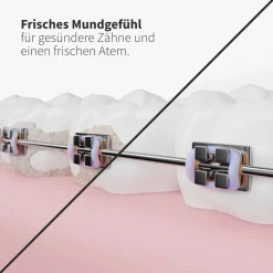 Ersatzdüsen Deep Care schwarz (6 Stück) - effektive Reinigung der Zahnzwischenräume|zahnheld Sale